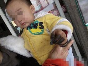图为：2012年2月2日，发生在晋江的一个儿童因玩引爆引发插座爆炸的事故照片